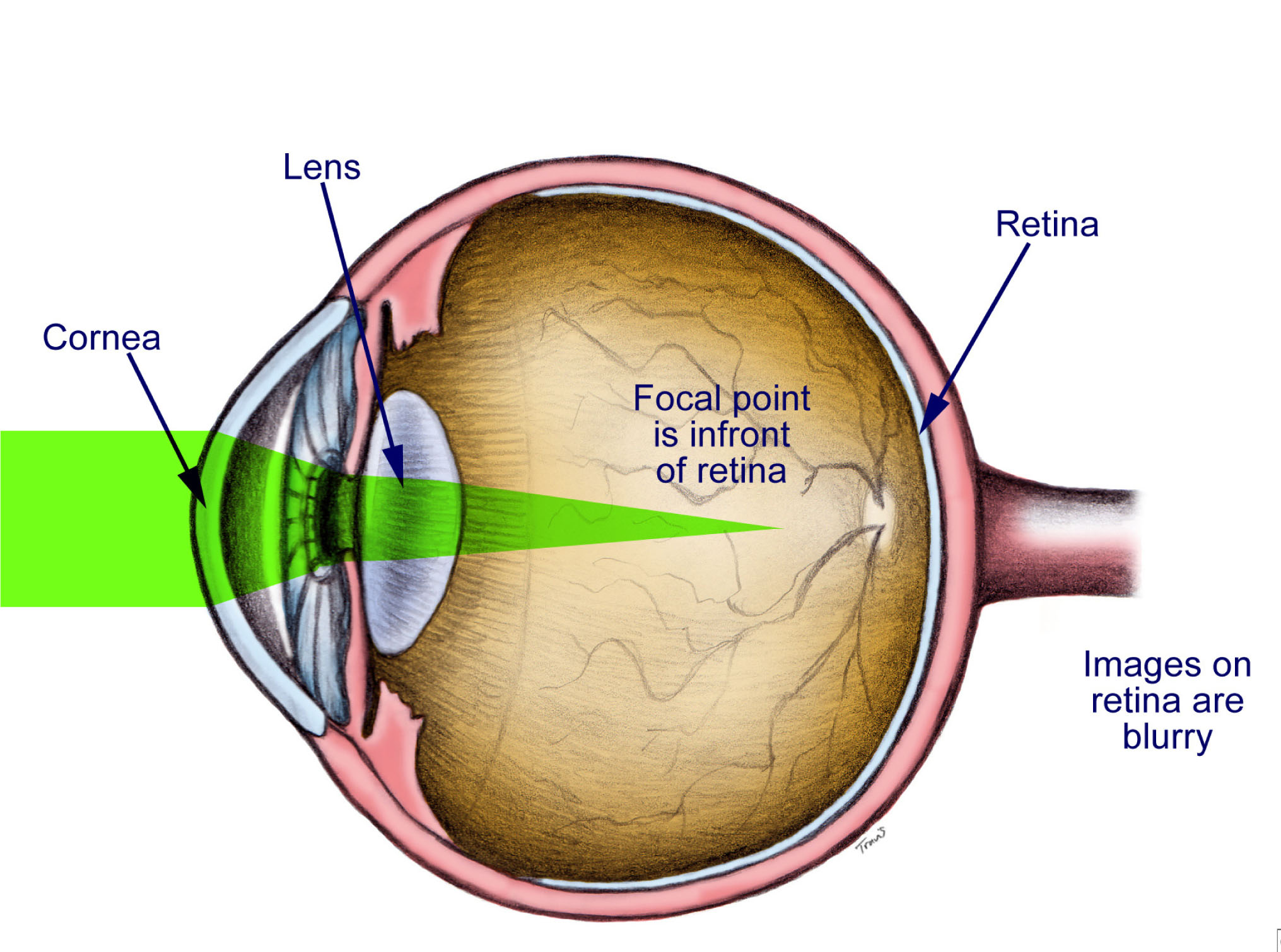 Pearl Optics